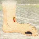 Image with missing alt attribute found on curejoy.com