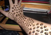 definici&oacute;n tripofobia