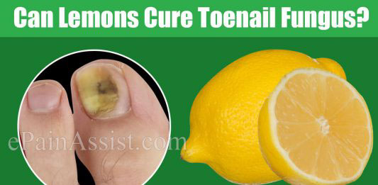 Image with missing alt attribute found on epainassist.com