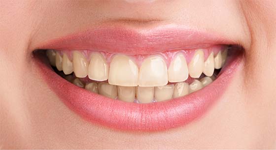 Image with missing alt attribute found on familydentistoc.com