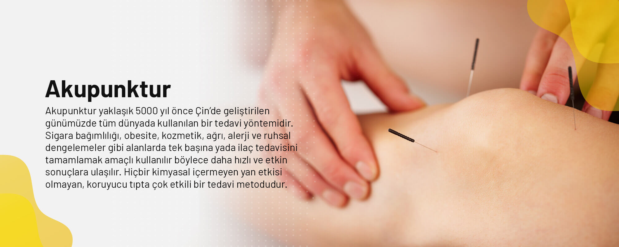 Image with missing alt attribute found on fuldenkucuk.com