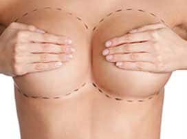 Image with missing alt attribute found on luxurgerynyc.com