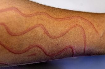 Image with missing alt attribute found on mdsaude.com