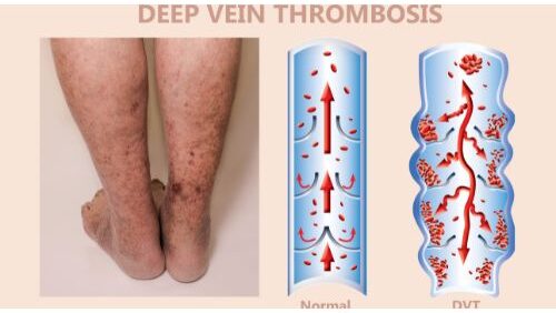 Image with missing alt attribute found on obaid.info