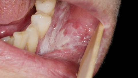 Image with missing alt attribute found on svtplay.se