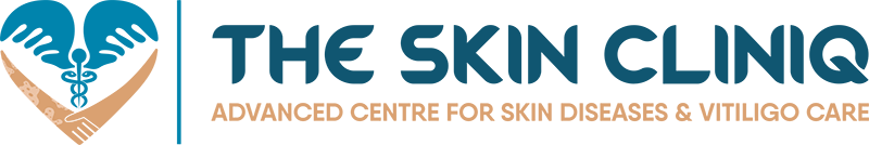 Skin Clinic in Adyar