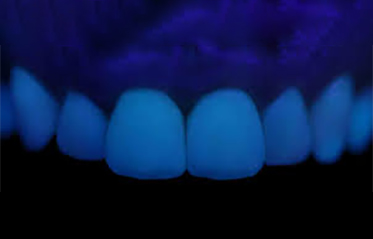 Image with missing alt attribute found on toothzone.com.au