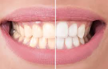 Image with missing alt attribute found on toothzone.com.au