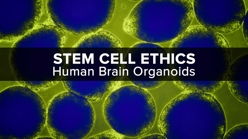 Image with missing alt attribute found on uctv.tv