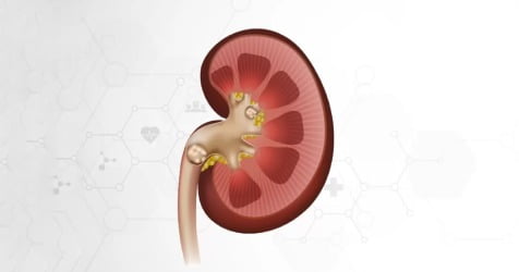 Image with missing alt attribute found on urocare.health