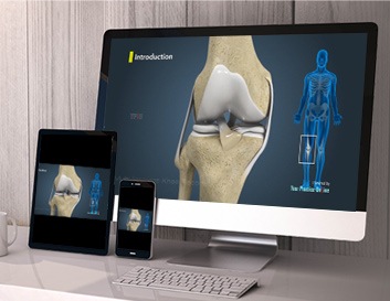 Image with missing alt attribute found on ypo.education