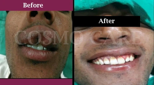 Image with missing alt attribute found on cosmocarejaipur.in