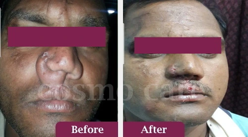 Image with missing alt attribute found on cosmocarejaipur.in
