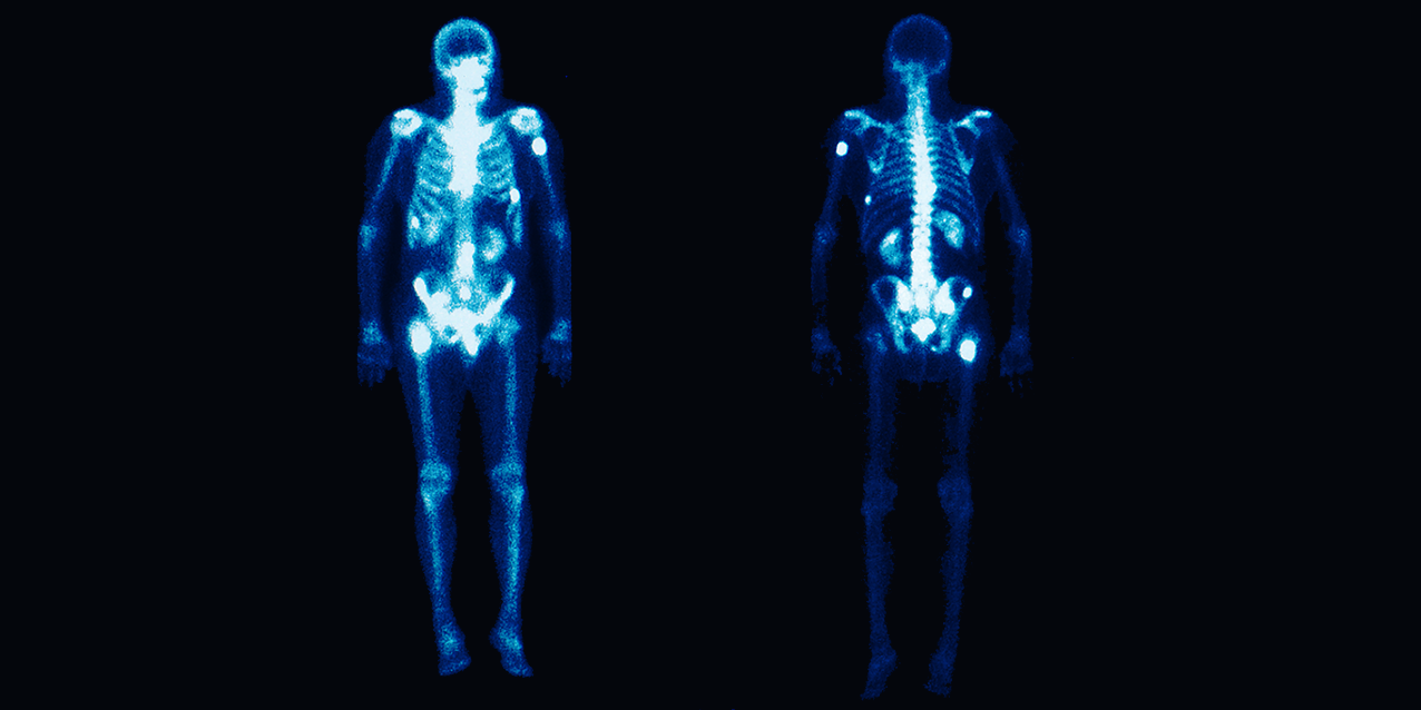 Image with missing alt attribute found on oecd-nea.org