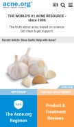 How acne.org looks like on a mobile device such as an iPhone.